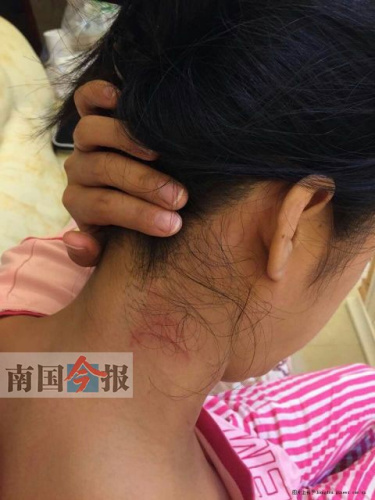 广西3女子赴宴遭官员猥亵1人反抗被暴打